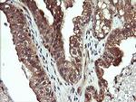 MAP2K1 Antibody in Immunohistochemistry (Paraffin) (IHC (P))