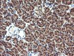 MAP2K1 Antibody in Immunohistochemistry (Paraffin) (IHC (P))