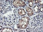 MAP2K1 Antibody in Immunohistochemistry (Paraffin) (IHC (P))