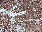 MAP2K1 Antibody in Immunohistochemistry (Paraffin) (IHC (P))