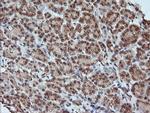 MAP2K1 Antibody in Immunohistochemistry (Paraffin) (IHC (P))