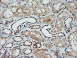 MAP2K1 Antibody in Immunohistochemistry (Paraffin) (IHC (P))