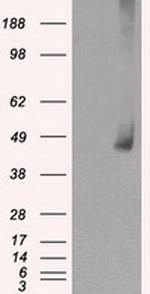 MAP2K1 Antibody in Western Blot (WB)
