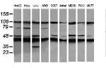 MAP2K1 Antibody in Western Blot (WB)