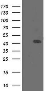 MAP2K1 Antibody in Western Blot (WB)