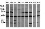 MAP2K1 Antibody in Western Blot (WB)