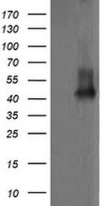 MAP2K1 Antibody in Western Blot (WB)