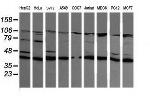 MAP2K1 Antibody in Western Blot (WB)