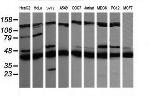 MAP2K1 Antibody in Western Blot (WB)