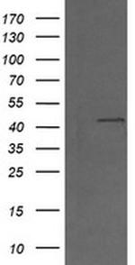 MAP2K1 Antibody in Western Blot (WB)