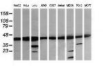 MAP2K1 Antibody in Western Blot (WB)