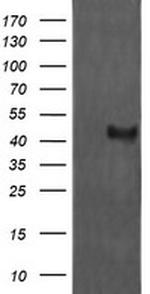 MAP2K1 Antibody in Western Blot (WB)