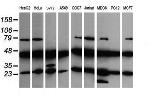 MAP2K1 Antibody in Western Blot (WB)