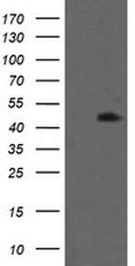 MAP2K1 Antibody in Western Blot (WB)