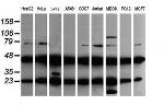 MAP2K1 Antibody in Western Blot (WB)