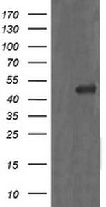 MAP2K1 Antibody in Western Blot (WB)