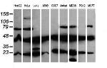 MAP2K1 Antibody in Western Blot (WB)