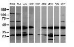 MAP2K1 Antibody in Western Blot (WB)