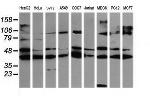 MAP2K1 Antibody in Western Blot (WB)