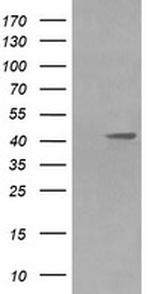 MAP2K1 Antibody in Western Blot (WB)