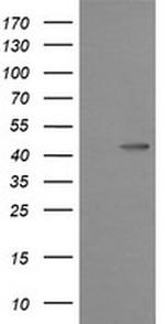 MAP2K1 Antibody in Western Blot (WB)