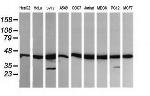 MAP2K1 Antibody in Western Blot (WB)