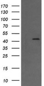 MAP2K1 Antibody in Western Blot (WB)