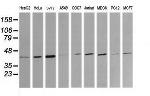 MAP2K1 Antibody in Western Blot (WB)