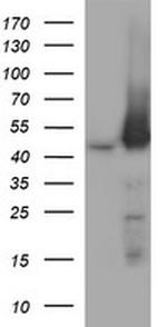 MAP2K1 Antibody in Western Blot (WB)