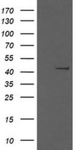 MAP2K1 Antibody in Western Blot (WB)