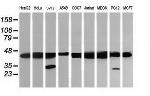 MAP2K1 Antibody in Western Blot (WB)