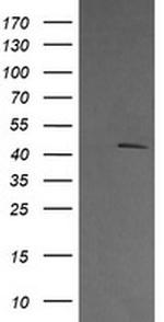 MAP2K1 Antibody in Western Blot (WB)