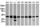 MAP2K1 Antibody in Western Blot (WB)