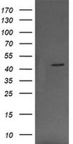 MAP2K1 Antibody in Western Blot (WB)