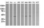 MAP2K1 Antibody in Western Blot (WB)