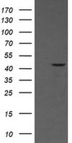 MAP2K1 Antibody in Western Blot (WB)