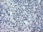 MAP2K2 Antibody in Immunohistochemistry (Paraffin) (IHC (P))