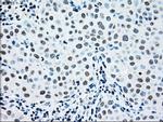 MAP2K2 Antibody in Immunohistochemistry (Paraffin) (IHC (P))