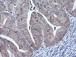 MAP2K3 Antibody in Immunohistochemistry (Paraffin) (IHC (P))