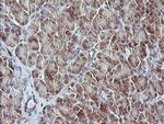 MAP2K3 Antibody in Immunohistochemistry (Paraffin) (IHC (P))
