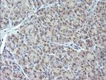 MAP2K3 Antibody in Immunohistochemistry (Paraffin) (IHC (P))