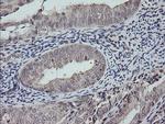 MAP2K3 Antibody in Immunohistochemistry (Paraffin) (IHC (P))