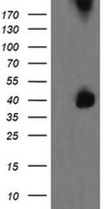 MAP2K3 Antibody in Western Blot (WB)