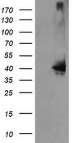 MAP2K3 Antibody in Western Blot (WB)