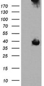 MAP2K3 Antibody in Western Blot (WB)