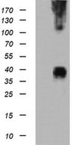 MAP2K3 Antibody in Western Blot (WB)