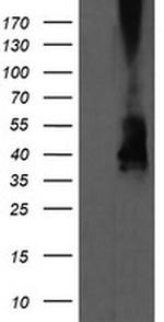 MAP2K3 Antibody in Western Blot (WB)