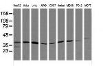 MAP2K3 Antibody in Western Blot (WB)