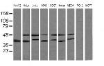 MAP2K3 Antibody in Western Blot (WB)