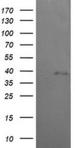 MAP2K3 Antibody in Western Blot (WB)